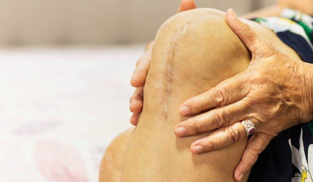 Can I Sue if I Receive a Faulty Knee Replacement?