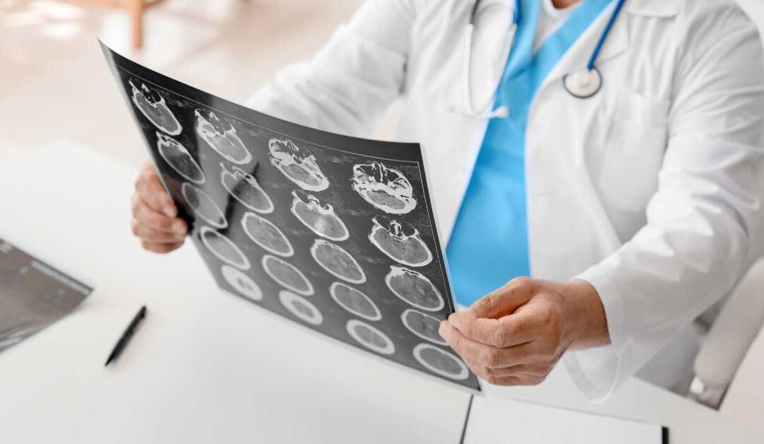 How To Build a Strong Case for Traumatic Brain Injury Compensation